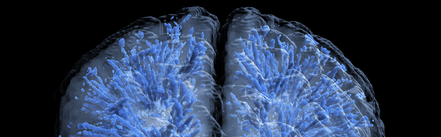 White Matter Glass Image